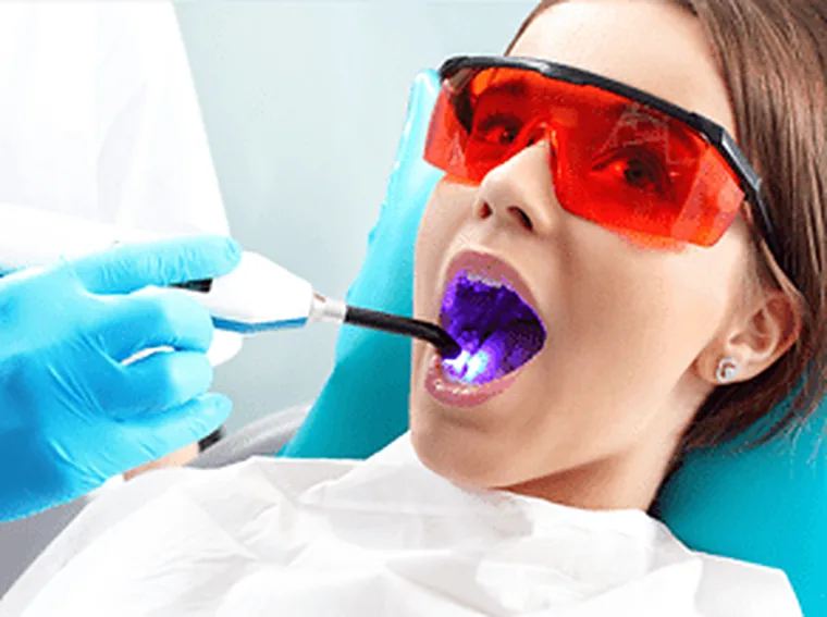 Tooth-Coloured Fillings