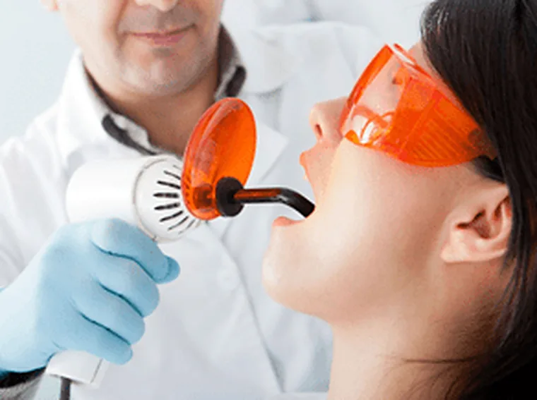 Sealants